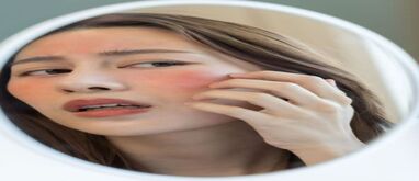 پیشگیری و درمان آفتاب‌سوختگی